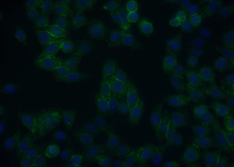 Immunofluorescent analysis of MCF-7 cells using Catalog No:108152(ARMC8 Antibody) at dilution of 1:25 and Alexa Fluor 488-congugated AffiniPure Goat Anti-Rabbit IgG(H+L)