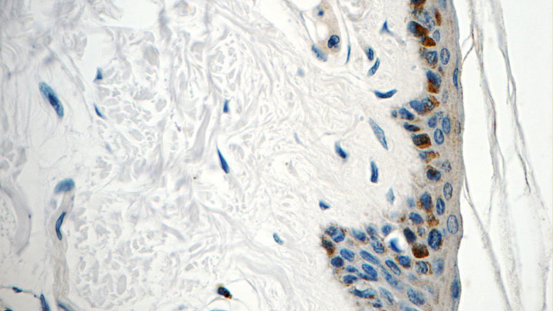 Immunohistochemistry of paraffin-embedded human skin tissue slide using Catalog No:115643(SPRR1B Antibody) at dilution of 1:50 (under 40x lens)