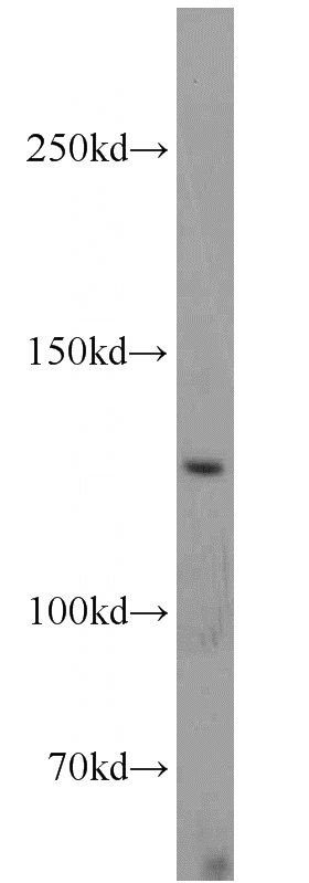 HepG2 cells were subjected to SDS PAGE followed by western blot with Catalog No:116625(UPF1 antibody) at dilution of 1:1000