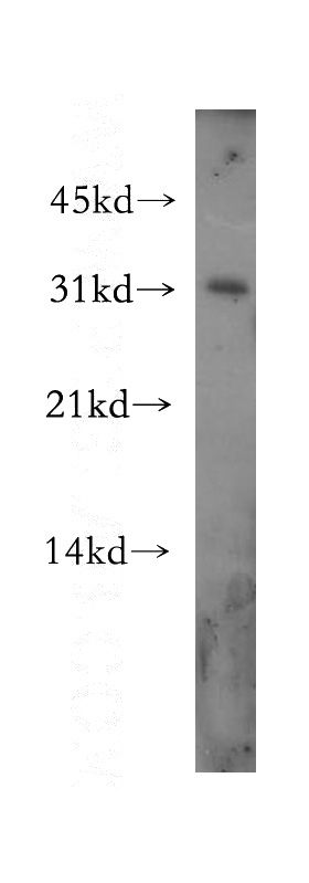 HeLa cells were subjected to SDS PAGE followed by western blot with Catalog No:108139(APH1A antibody) at dilution of 1:500
