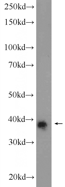 mouse colon tissue were subjected to SDS PAGE followed by western blot with Catalog No:111689(IGFBP7 Antibody) at dilution of 1:300