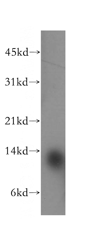 human brain tissue were subjected to SDS PAGE followed by western blot with Catalog No:107757(ACYP1 antibody) at dilution of 1:500