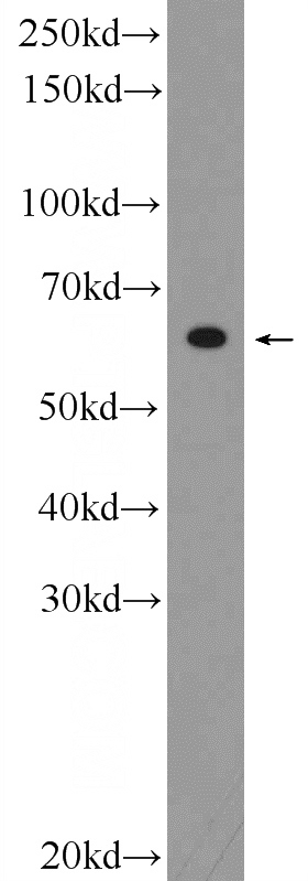 SMMC-7721 cells were subjected to SDS PAGE followed by western blot with Catalog No:108698(C20orf195 Antibody) at dilution of 1:300