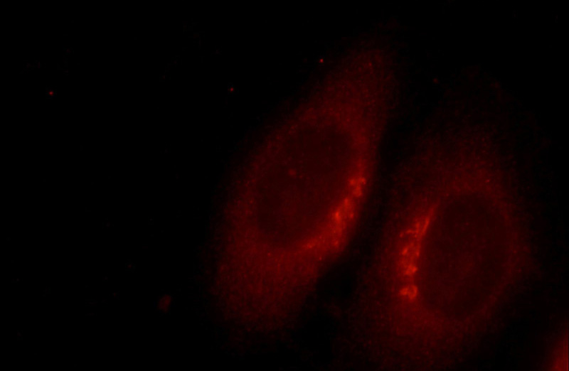Immunofluorescent analysis of HepG2 cells using Catalog No:116253(TOR2A Antibody) at dilution of 1:25 and Rhodamine-Goat anti-Rabbit IgG