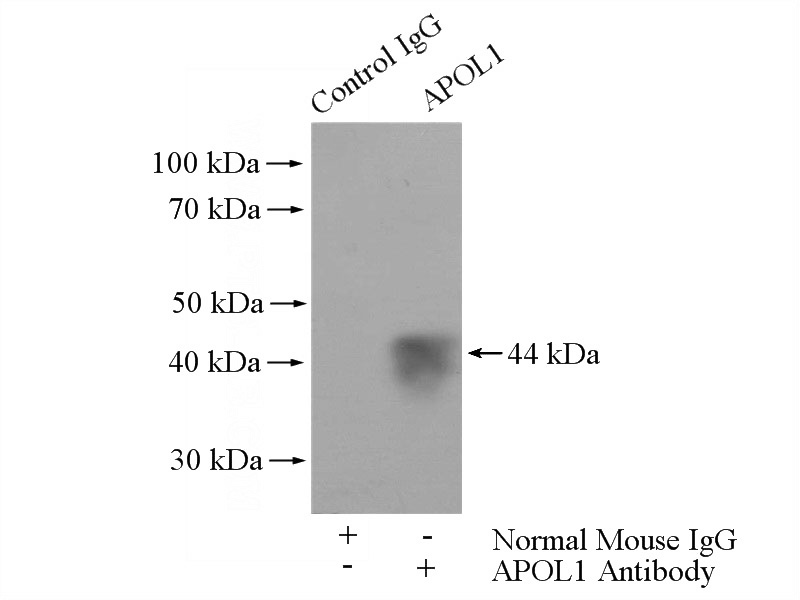 IP Result of anti-APOL1 (IP:Catalog No:107065, 5ug; Detection:Catalog No:107065 1:10000) with human plasma tissue lysate 4000ug.