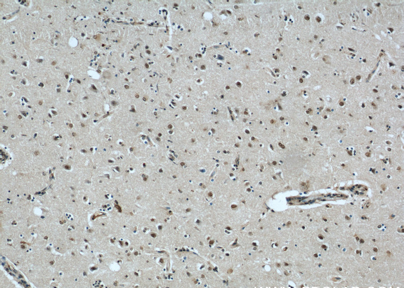Immunohistochemical of paraffin-embedded human brain using Catalog No:110597(FAM71E2 antibody) at dilution of 1:50 (under 10x lens)