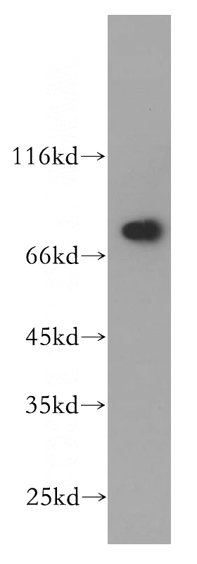 HeLa cells were subjected to SDS PAGE followed by western blot with Catalog No:110290(ECD antibody) at dilution of 1:300