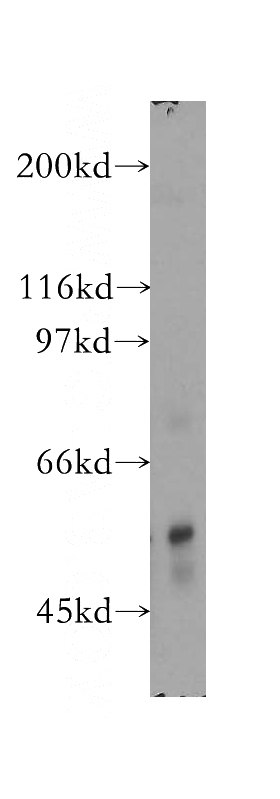 human heart tissue were subjected to SDS PAGE followed by western blot with Catalog No:114110(PPP3CB antibody) at dilution of 1:400