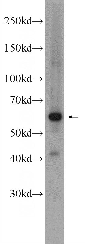 human placenta tissue were subjected to SDS PAGE followed by western blot with Catalog No:113939(ALPP Antibody) at dilution of 1:600