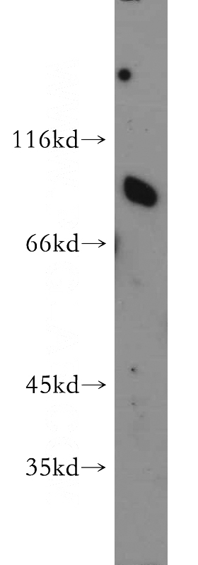 human brain tissue were subjected to SDS PAGE followed by western blot with Catalog No:115664(SCARB1 antibody) at dilution of 1:500