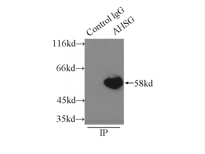 IP Result of anti-AHSG (IP:Catalog No:107206, 3ug; Detection:Catalog No:107206 1:3000) with HepG2 cells lysate 6000ug.