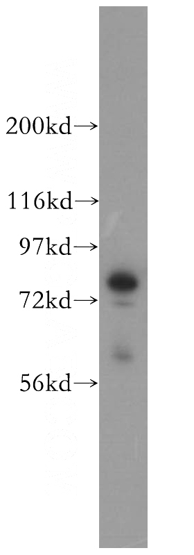 mouse pancreas tissue were subjected to SDS PAGE followed by western blot with Catalog No:114521(RDX antibody) at dilution of 1:1000