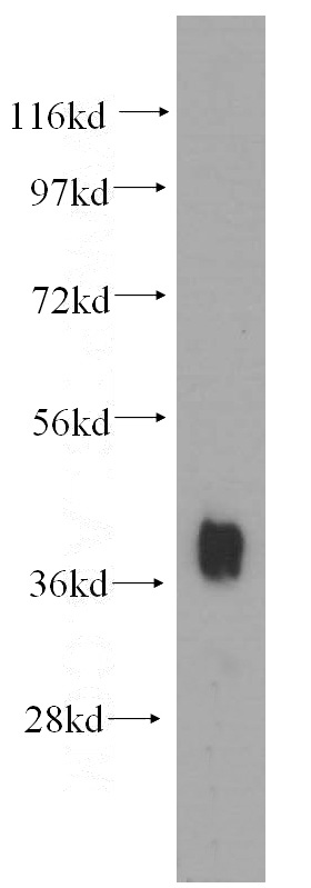 human heart tissue were subjected to SDS PAGE followed by western blot with Catalog No:113204(NKX2-5 antibody) at dilution of 1:1200