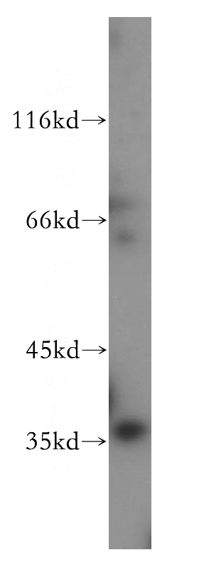 HL-60 cells were subjected to SDS PAGE followed by western blot with Catalog No:113600(PARVG antibody) at dilution of 1:500