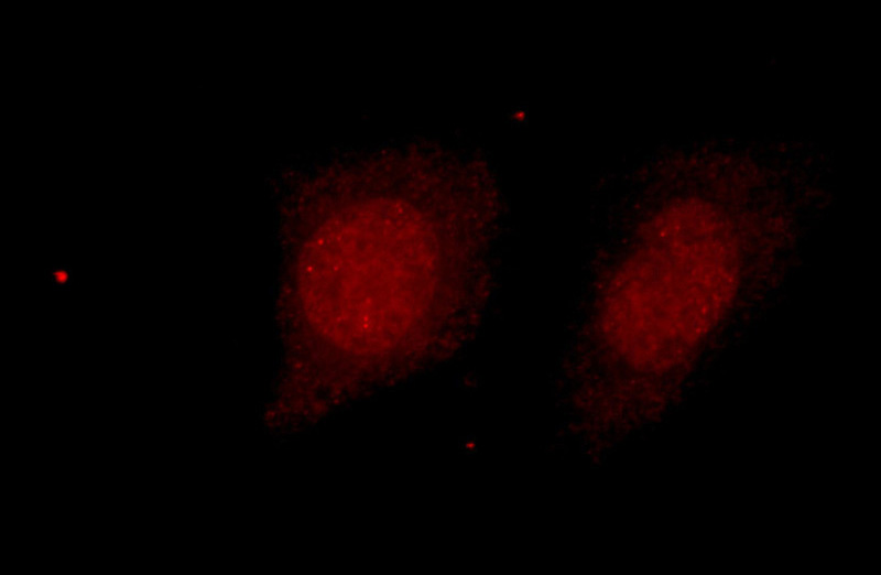 Immunofluorescent analysis of HeLa cells using Catalog No:111374(HDAC2-specific Antibody) at dilution of 1:25 and Rhodamine-Goat anti-Rabbit IgG