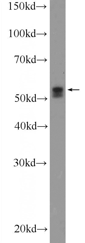 COLO 320 cells were subjected to SDS PAGE followed by western blot with Catalog No:116321(TRIM6 Antibody) at dilution of 1:1000