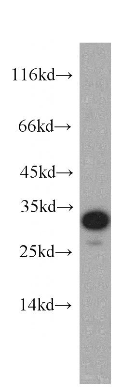 HeLa cells were subjected to SDS PAGE followed by western blot with Catalog No:114356(PYCR2 antibody) at dilution of 1:500