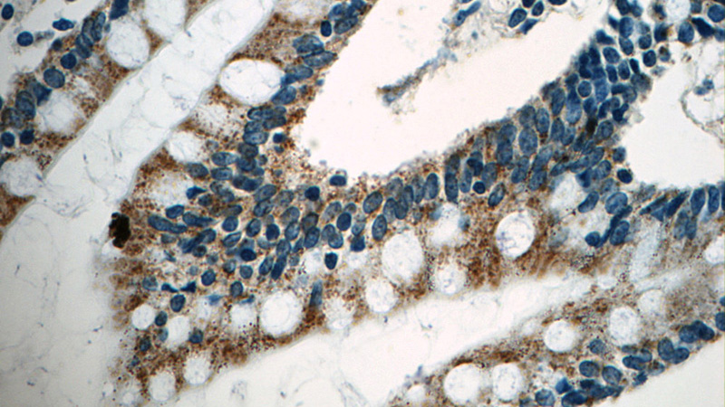 Immunohistochemistry of paraffin-embedded human small intestine tissue slide using Catalog No:117074(ENPP2 Antibody) at dilution of 1:50