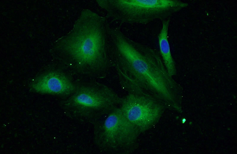 Immunofluorescent analysis of A549 cells using Catalog No:111933(IRS1 Antibody) at dilution of 1:50 and Alexa Fluor 488-congugated AffiniPure Goat Anti-Rabbit IgG(H+L)