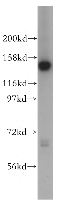 Jurkat cells were subjected to SDS PAGE followed by western blot with Catalog No:115234(SIN3A antibody) at dilution of 1:500