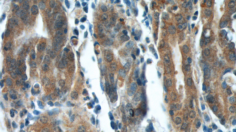Immunohistochemistry of paraffin-embedded human stomach tissue slide using Catalog No:110635(FGF5 Antibody) at dilution of 1:200 (under 40x lens).