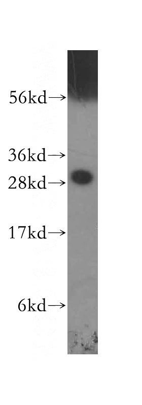 A375 cells were subjected to SDS PAGE followed by western blot with Catalog No:107659(14-3-3E antibody) at dilution of 1:500