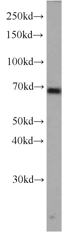 HeLa cells were subjected to SDS PAGE followed by western blot with Catalog No:111144(GPSM2 antibody) at dilution of 1:500