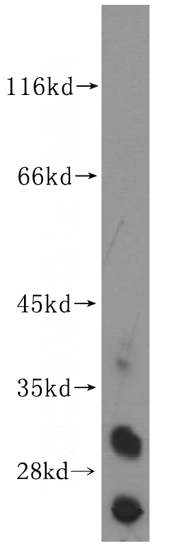 HeLa cells were subjected to SDS PAGE followed by western blot with Catalog No:116866(WDR4 antibody) at dilution of 1:300