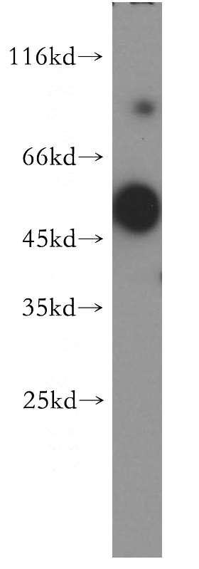 human brain tissue were subjected to SDS PAGE followed by western blot with Catalog No:117247(BRUNOL6 antibody) at dilution of 1:500