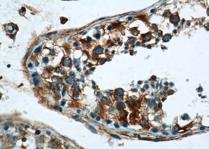 Immunohistochemistry of paraffin-embedded human testis tissue slide using Catalog No:114864(RTN4 Antibody) at dilution of 1:50 (under 40x lens)