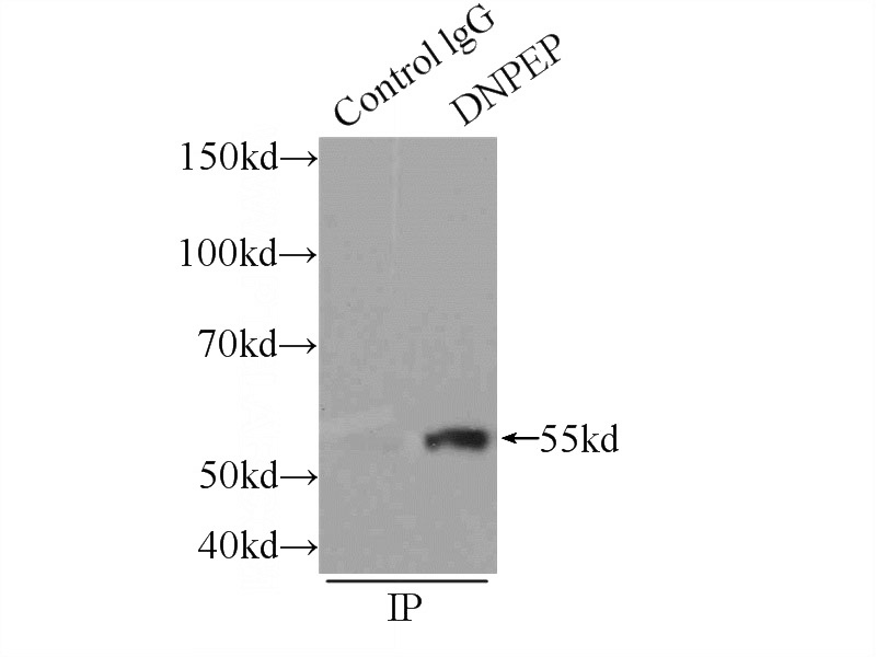 IP Result of anti-DNPEP (IP:Catalog No:109971, 3ug; Detection:Catalog No:109971 1:500) with HEK-293 cells lysate 1760ug.