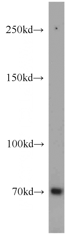 3T3-L1 cells were subjected to SDS PAGE followed by western blot with Catalog No:115501(SORBS1 antibody) at dilution of 1:800