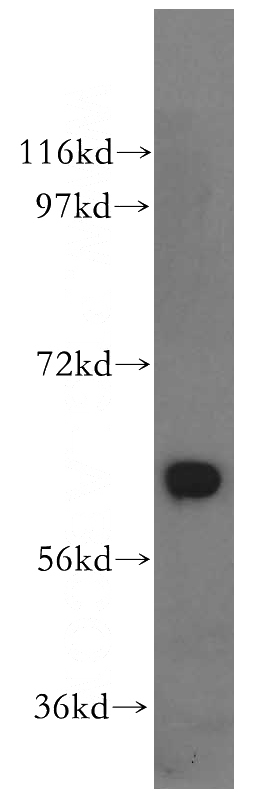PC-3 cells were subjected to SDS PAGE followed by western blot with Catalog No:111064(GPI antibody) at dilution of 1:500