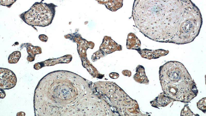 Immunohistochemistry of paraffin-embedded human placenta tissue slide using Catalog No:114659(RHOBTB3 Antibody) at dilution of 1:50 (under 10x lens)
