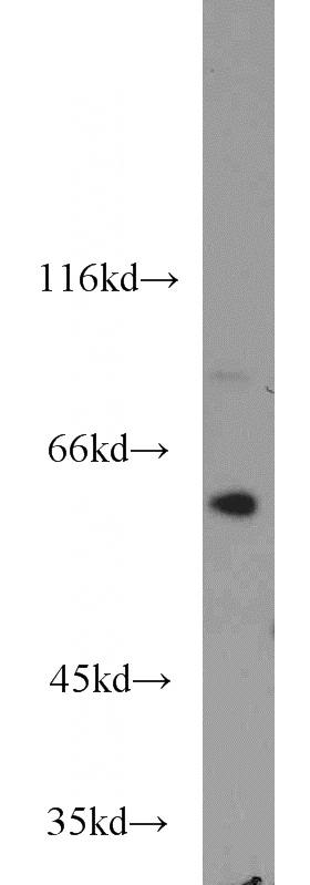 Jurkat cells were subjected to SDS PAGE followed by western blot with Catalog No:116463(U2AF2 antibody) at dilution of 1:1000