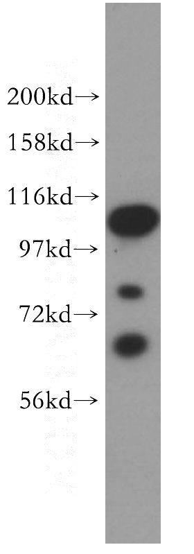 Jurkat cells were subjected to SDS PAGE followed by western blot with Catalog No:108287(ATF6B antibody) at dilution of 1:1000
