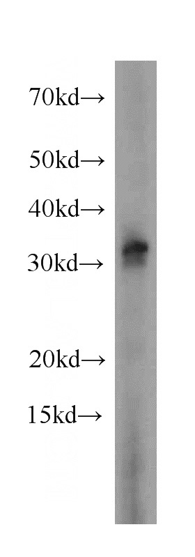 A431 cells were subjected to SDS PAGE followed by western blot with Catalog No:111366(H1F0 antibody) at dilution of 1:500