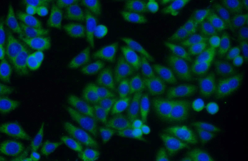 Immunofluorescent analysis of HepG2 cells using Catalog No:116138(TIMP1 Antibody) at dilution of 1:50 and Alexa Fluor 488-congugated AffiniPure Goat Anti-Rabbit IgG(H+L)
