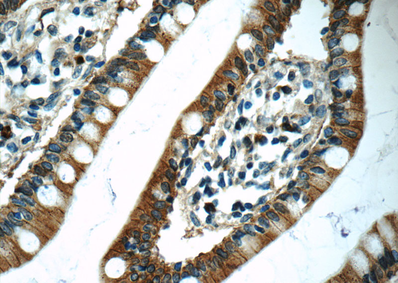 Immunohistochemistry of paraffin-embedded human small intestine tissue slide using Catalog No:108849(CPA3 Antibody) at dilution of 1:50 (under 40x lens)