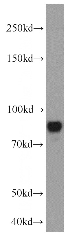 SH-SY5Y cells were subjected to SDS PAGE followed by western blot with Catalog No:112474(MAP2 antibody) at dilution of 1:1000