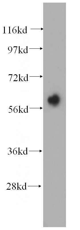 mouse skin tissue were subjected to SDS PAGE followed by western blot with Catalog No:112134(KRT6B antibody) at dilution of 1:1000