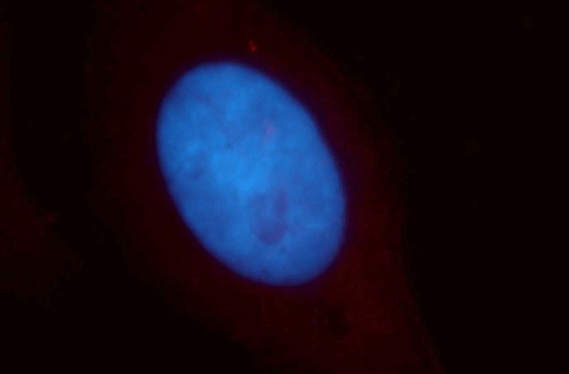 Immunofluorescent analysis of HepG2 cells, using IKZF3 antibody Catalog No:111650 at 1:25 dilution and Rhodamine-labeled goat anti-rabbit IgG (red). Blue pseudocolor = DAPI (fluorescent DNA dye).