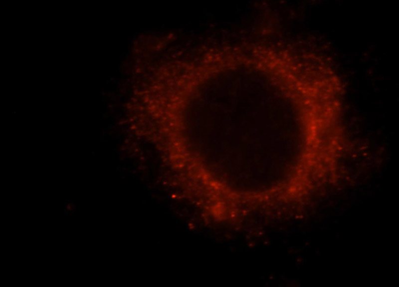 Immunofluorescent analysis of Hela cells, using RB1CC1 antibody Catalog No:114585 at 1:25 dilution and Rhodamine-labeled goat anti-rabbit IgG (red).