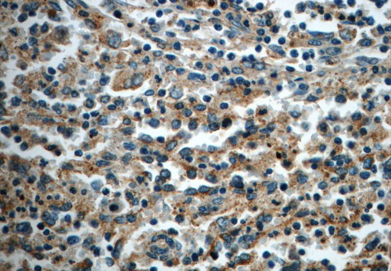 Immunohistochemistry of paraffin-embedded human spleen slide using Catalog No:114778(RocK1-Specific Antibody) at dilution of 1:50