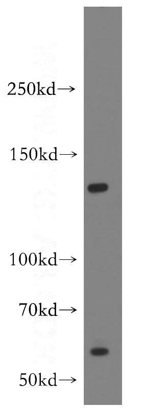 Jurkat cells were subjected to SDS PAGE followed by western blot with Catalog No:110429(F4-80 antibody) at dilution of 1:500