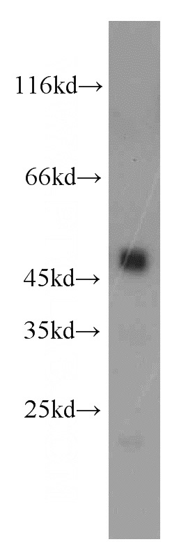 mouse pancreas tissue were subjected to SDS PAGE followed by western blot with Catalog No:109505(PASP antibody) at dilution of 1:1000