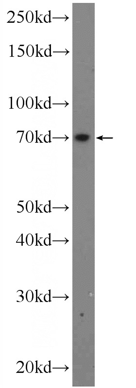 mouse small intestine tissue were subjected to SDS PAGE followed by western blot with Catalog No:108067(ANKRD13B Antibody) at dilution of 1:600