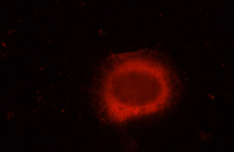 Immunofluorescent analysis of MCF-7 cells, using ERC1 antibody Catalog No:110405 at 1:50 dilution and Rhodamine-labeled goat anti-rabbit IgG (red).