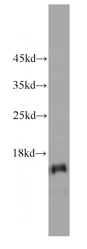 human kidney tissue were subjected to SDS PAGE followed by western blot with Catalog No:107326(NDUFS5 antibody) at dilution of 1:1000