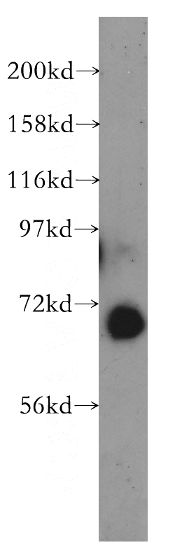 human lung tissue were subjected to SDS PAGE followed by western blot with Catalog No:110892(GBP2 antibody) at dilution of 1:400